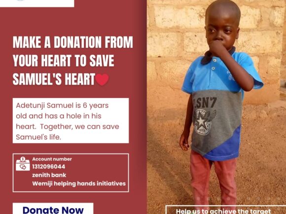 Support Samuel Adetunji’s Surgery Fund